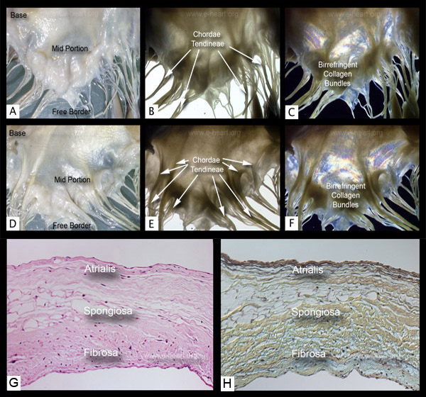 Mitral Valve Close Up